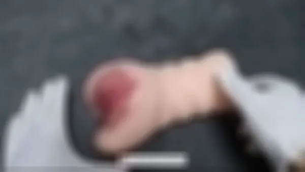 Sensitive Content